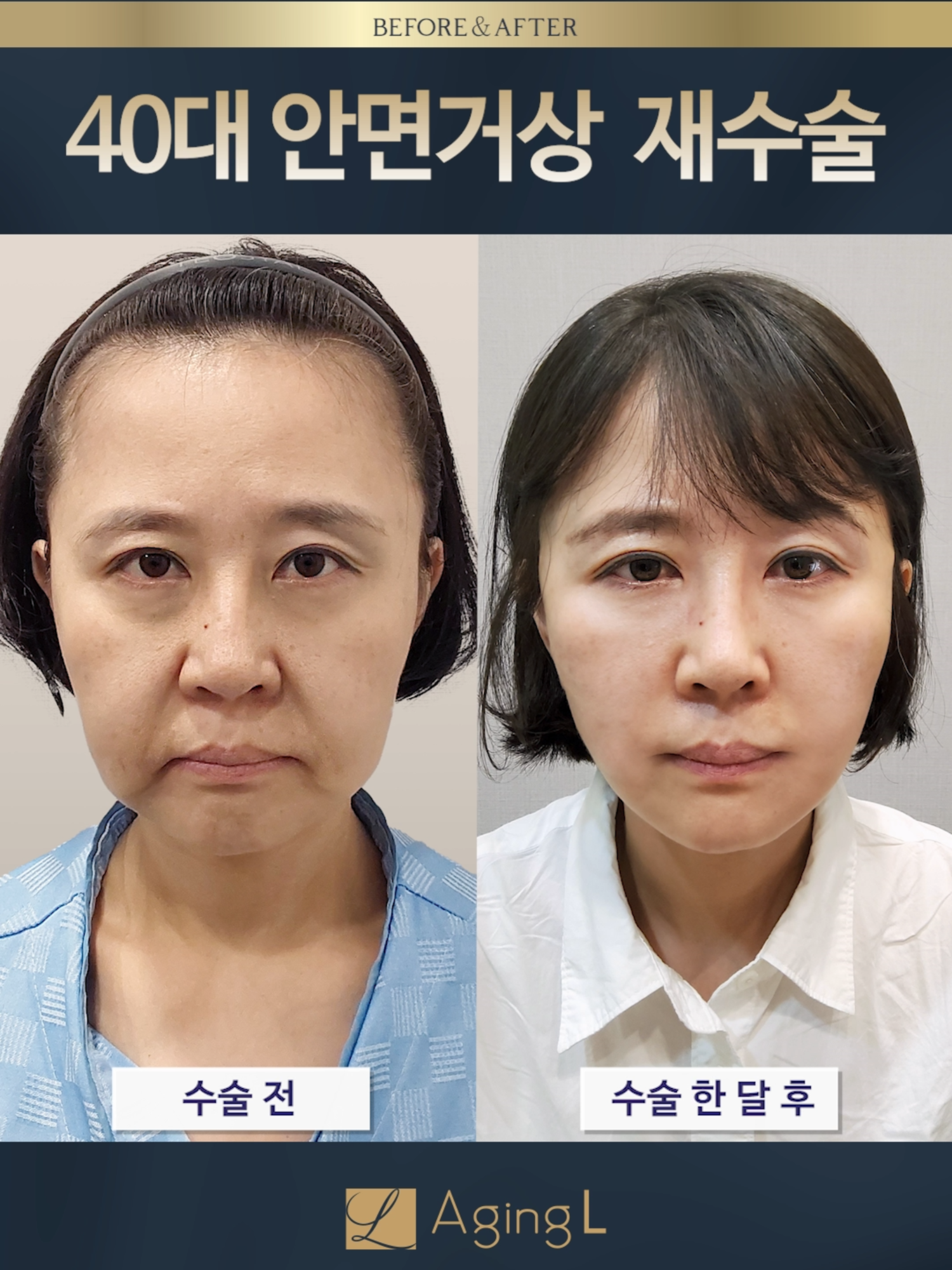 @agingl_official