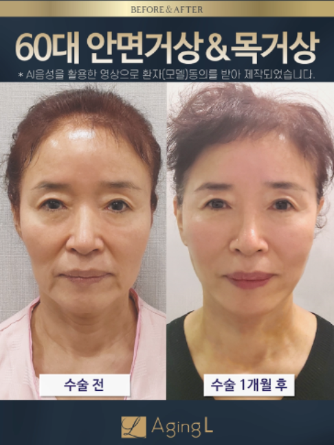 @agingl_official