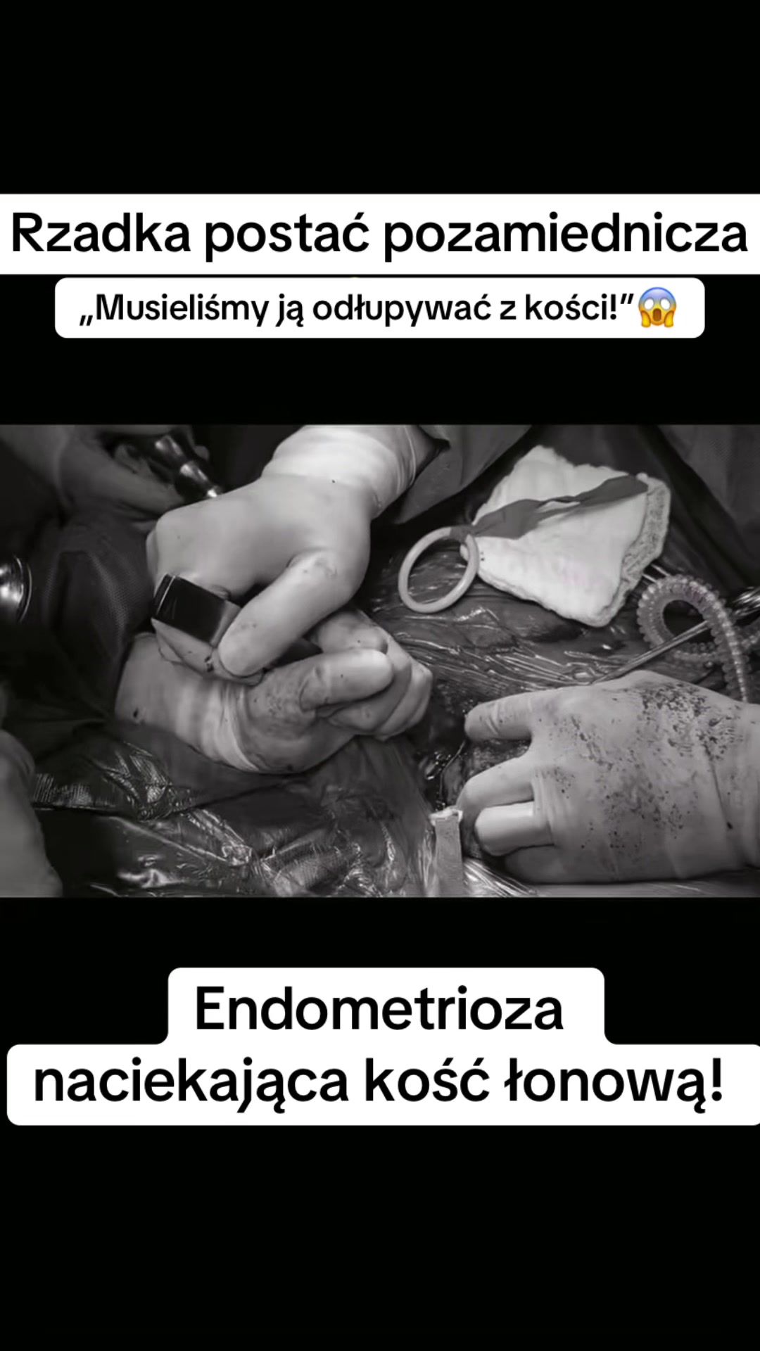 @EndoMona🎗️