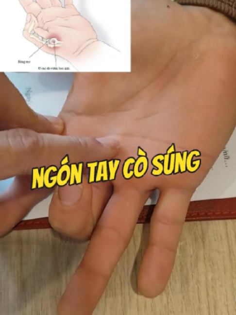 @Chuyên gia xương khớp