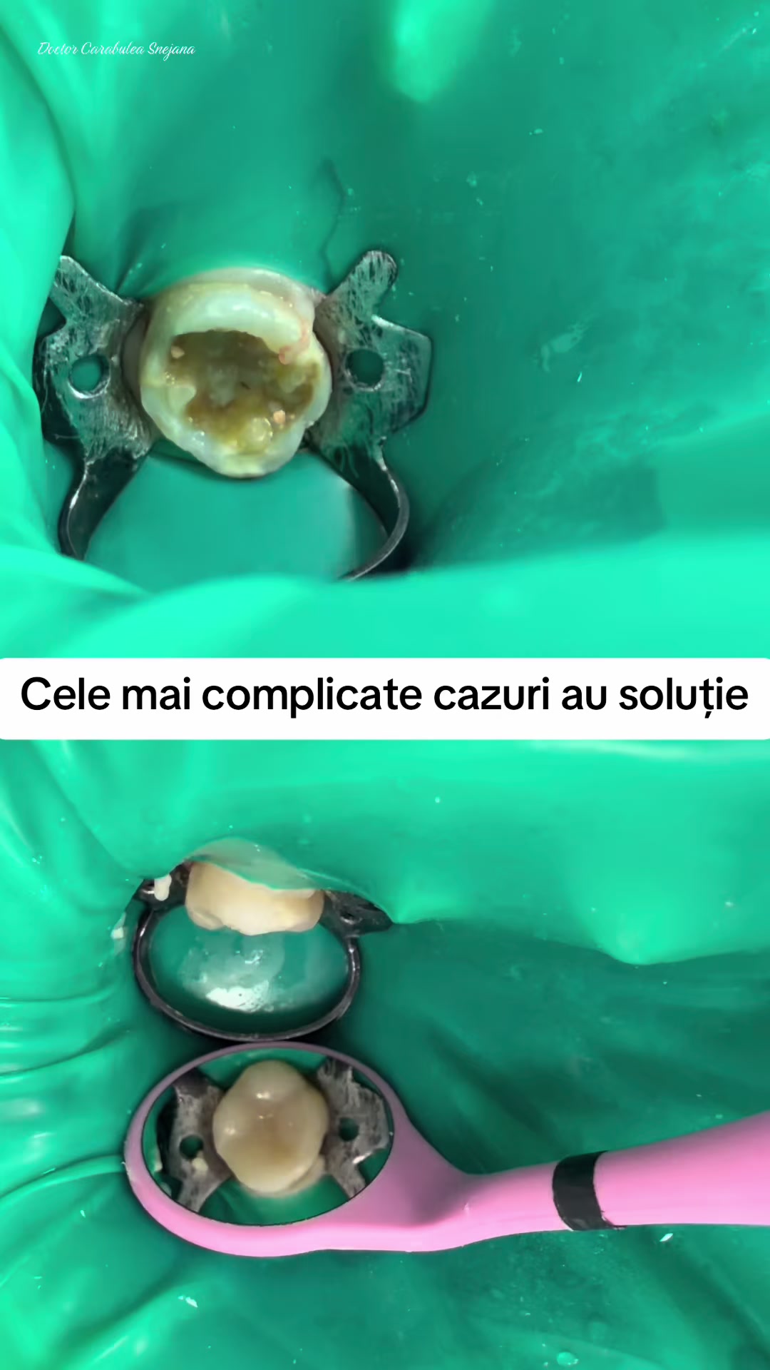 @Stomatolog Snejana Carabulea🦷