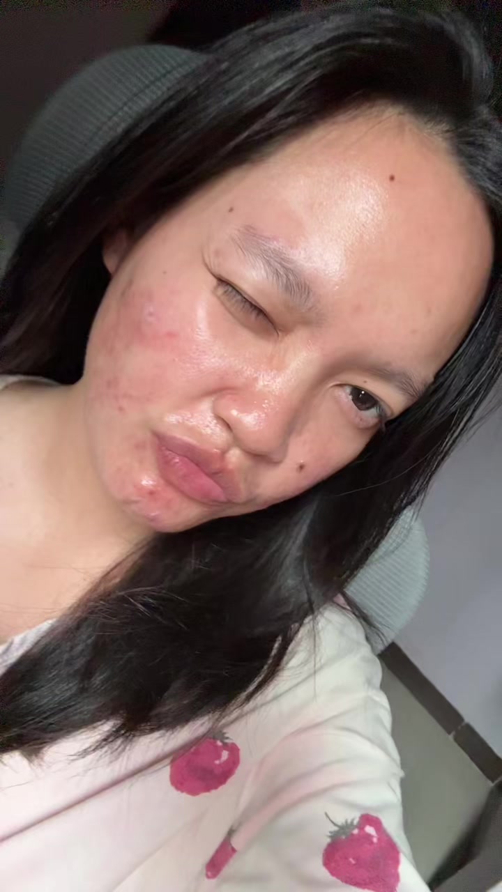 @Nai