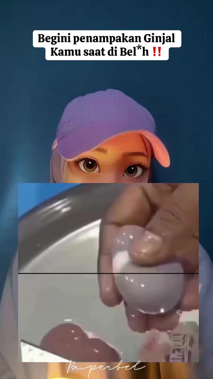 @B U P E R