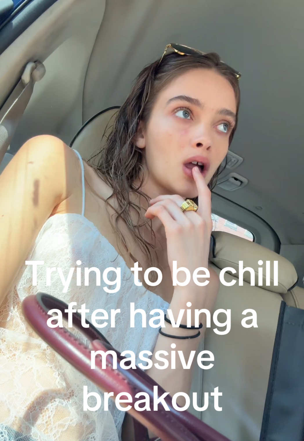 @P&Uacute;RPURA