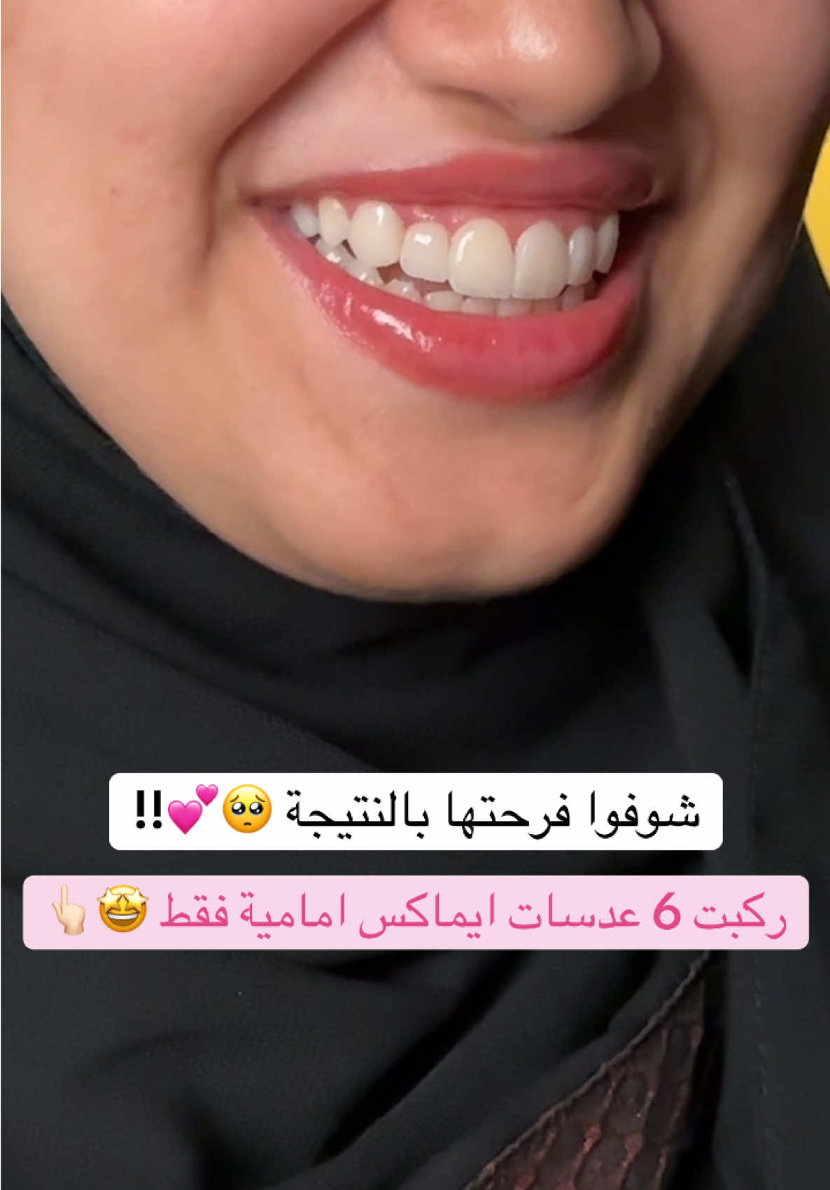 @Dr.lina_almasmoum