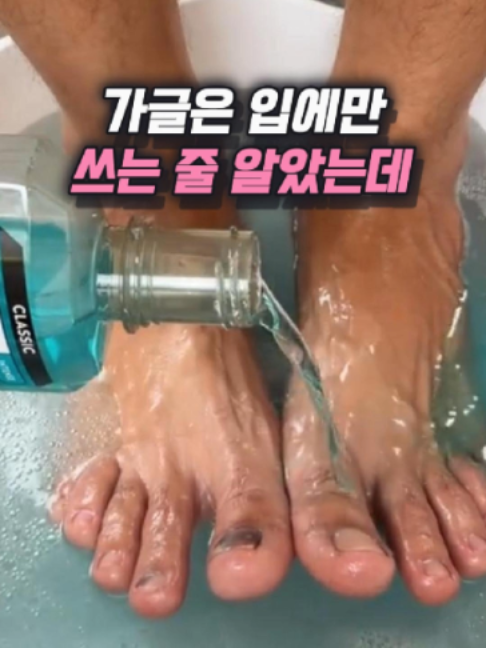 @나나꿀템