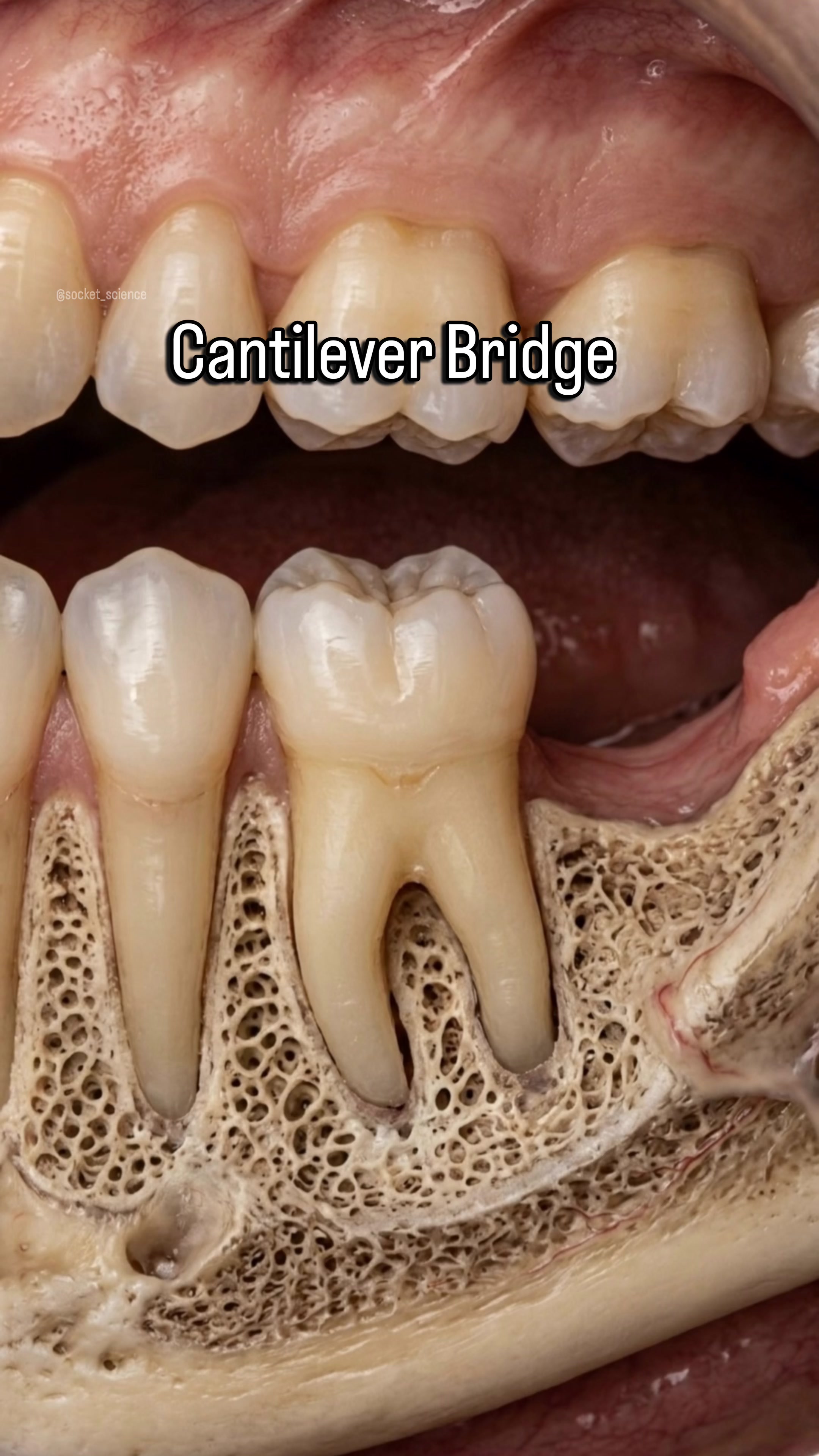 @Socket Science | Dental Visual