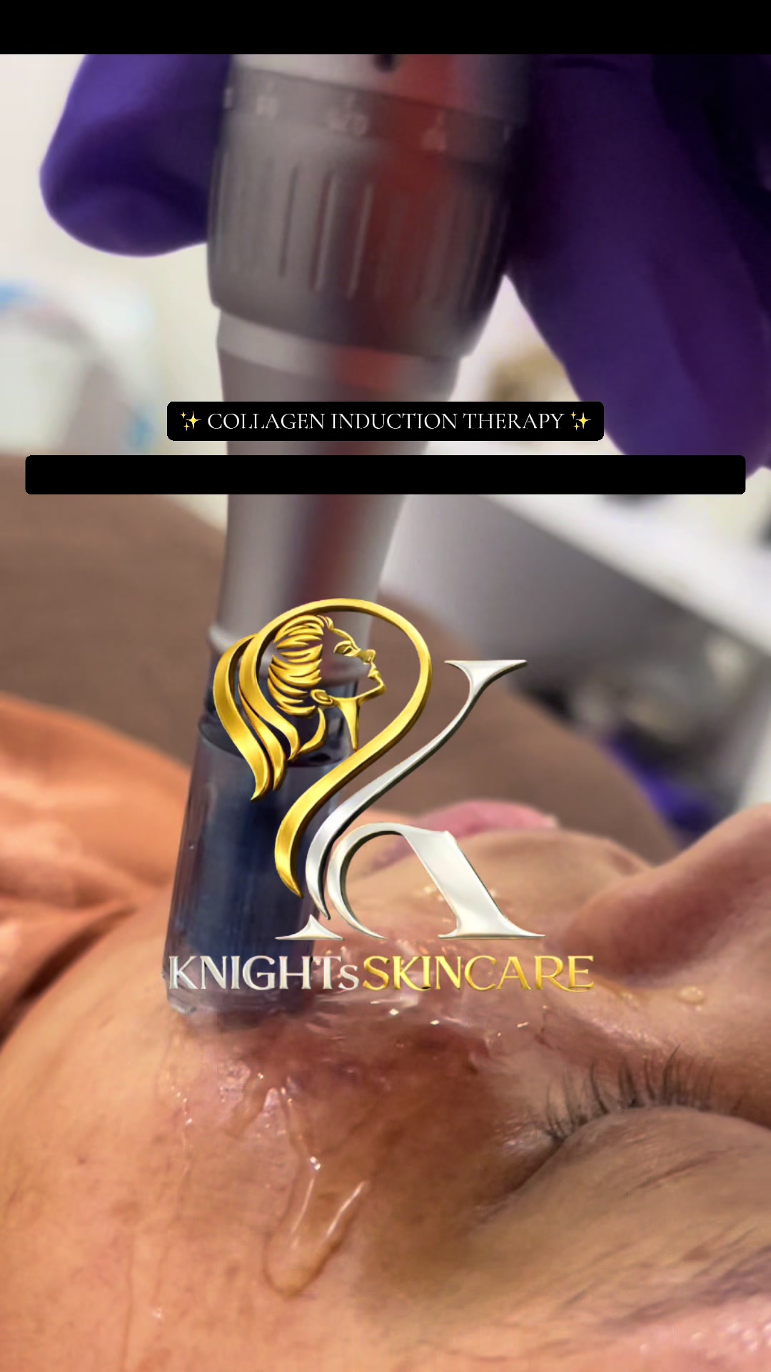 @KNIGHTS | SKINCARE | KENYA