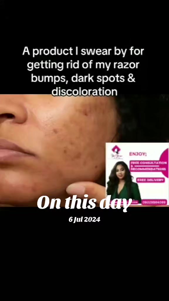 @YearsYoungerSkincare