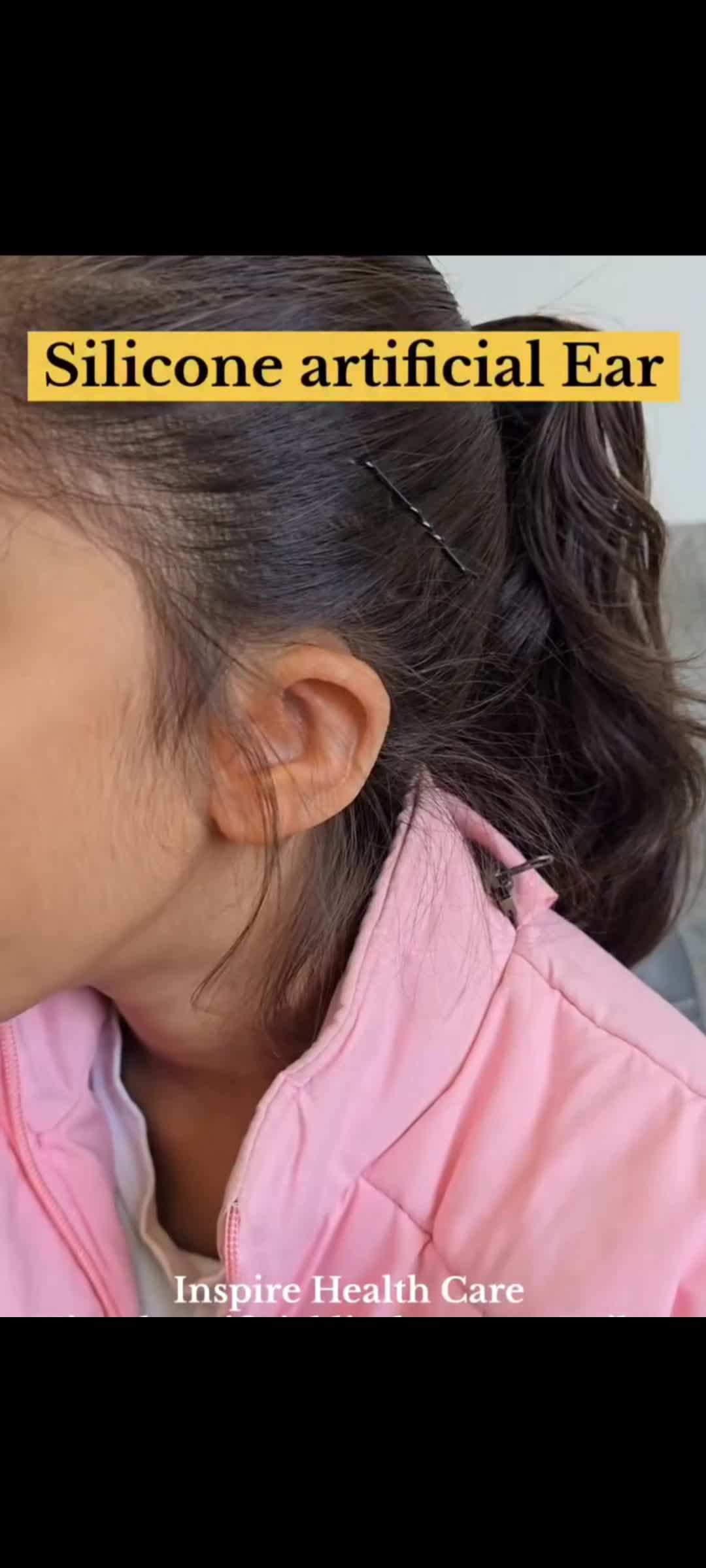 @مصنوعی اعضاء
