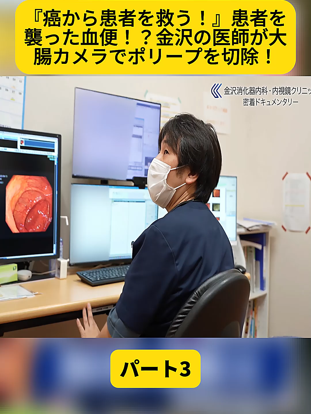 @金沢内視鏡医 医療密着ドキュメンタリー
