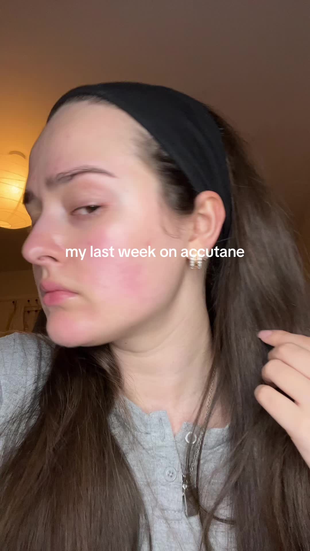 @andreea_skintok