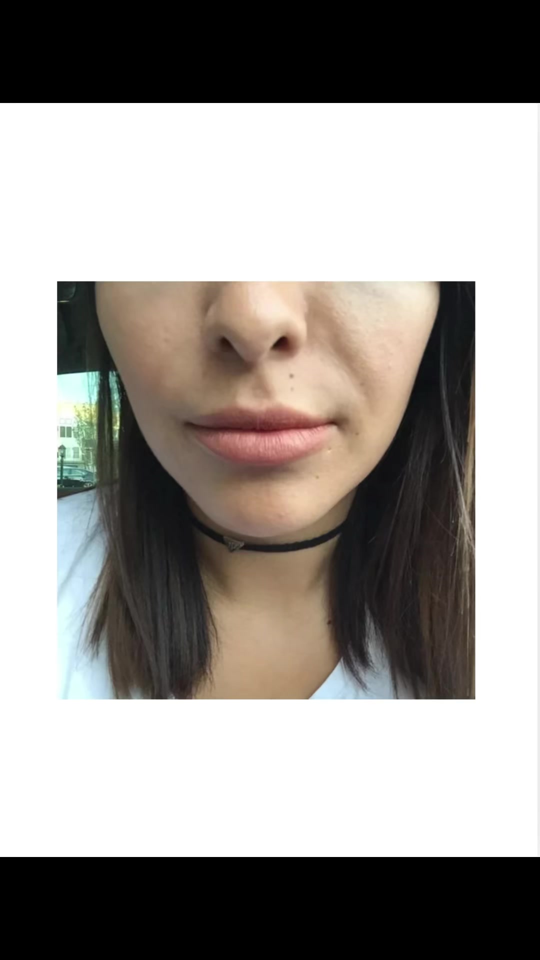 @DrMaxZygo