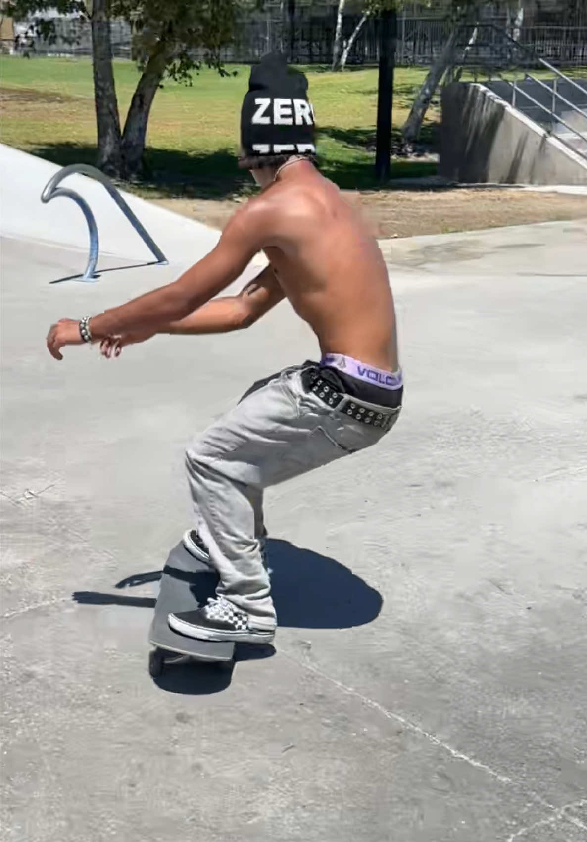 @anthonyrare