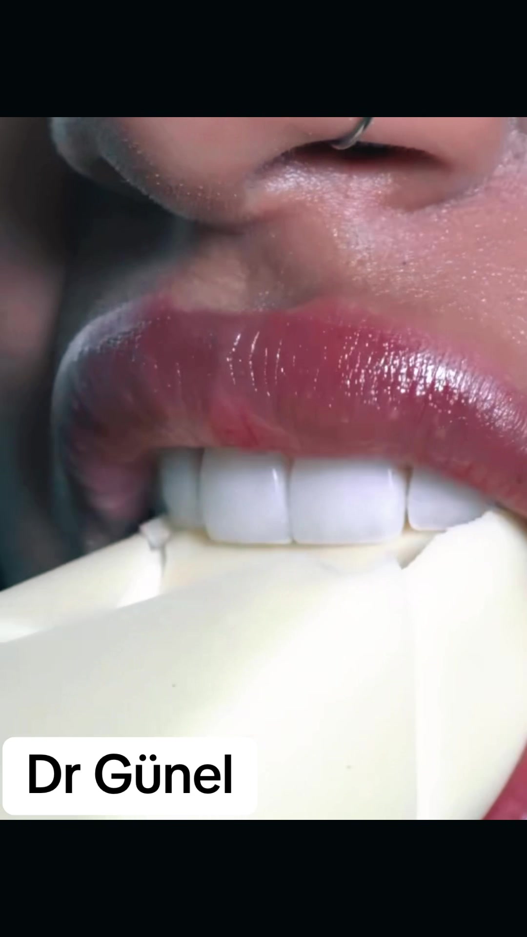 @Dentist_G&uuml;nel