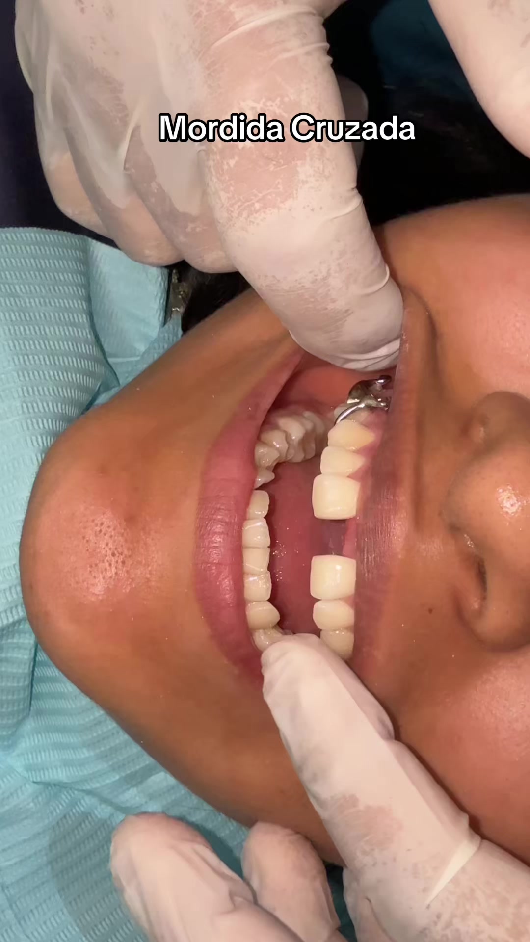 @DentikaBrackets