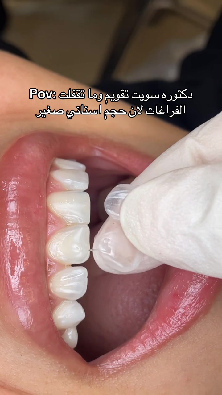 @Dr. Abrar Alhababi