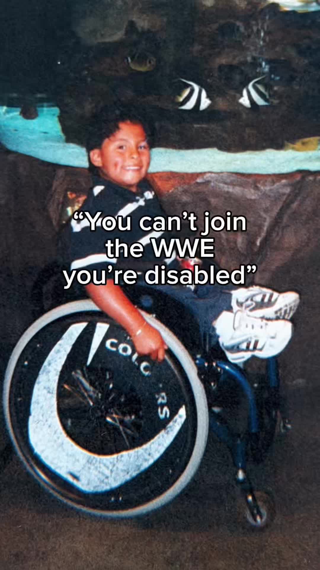 @No Femur Kid