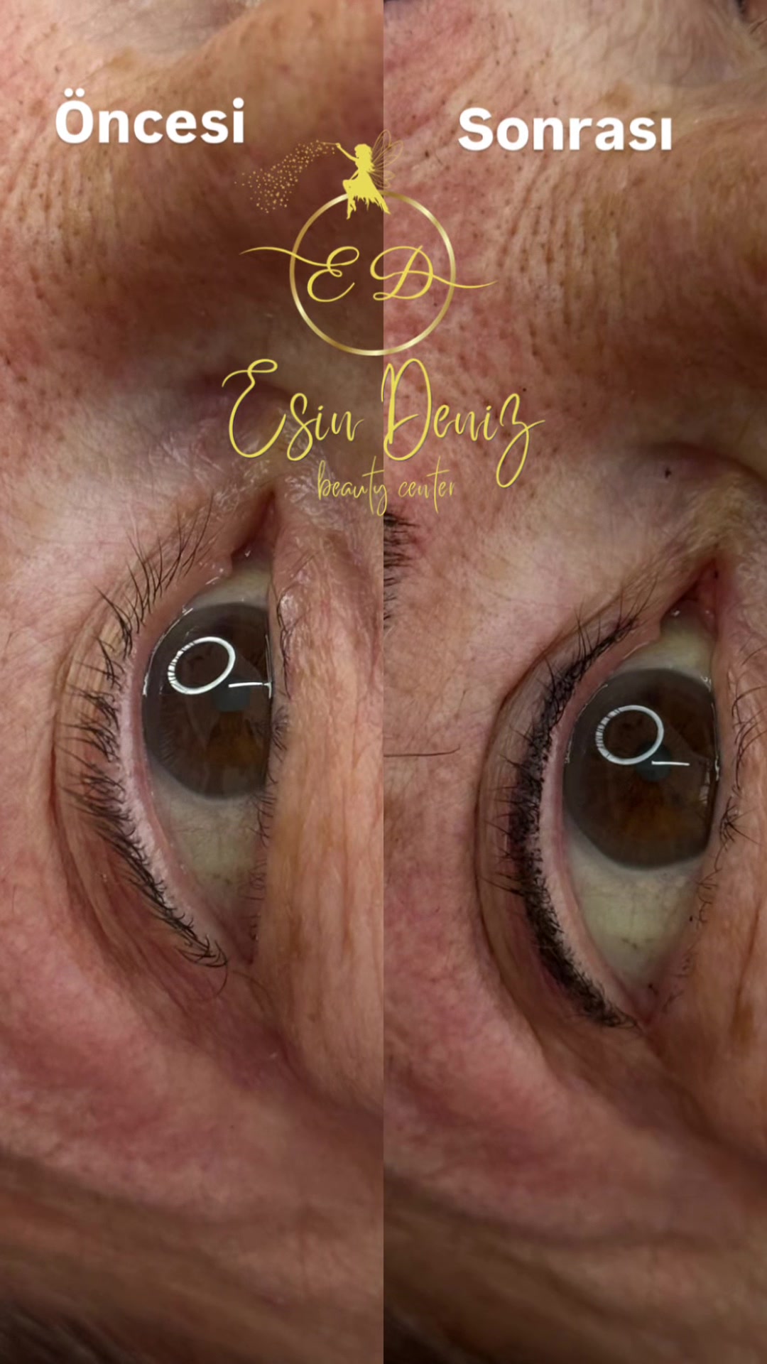 @Esin Deniz Beauty center