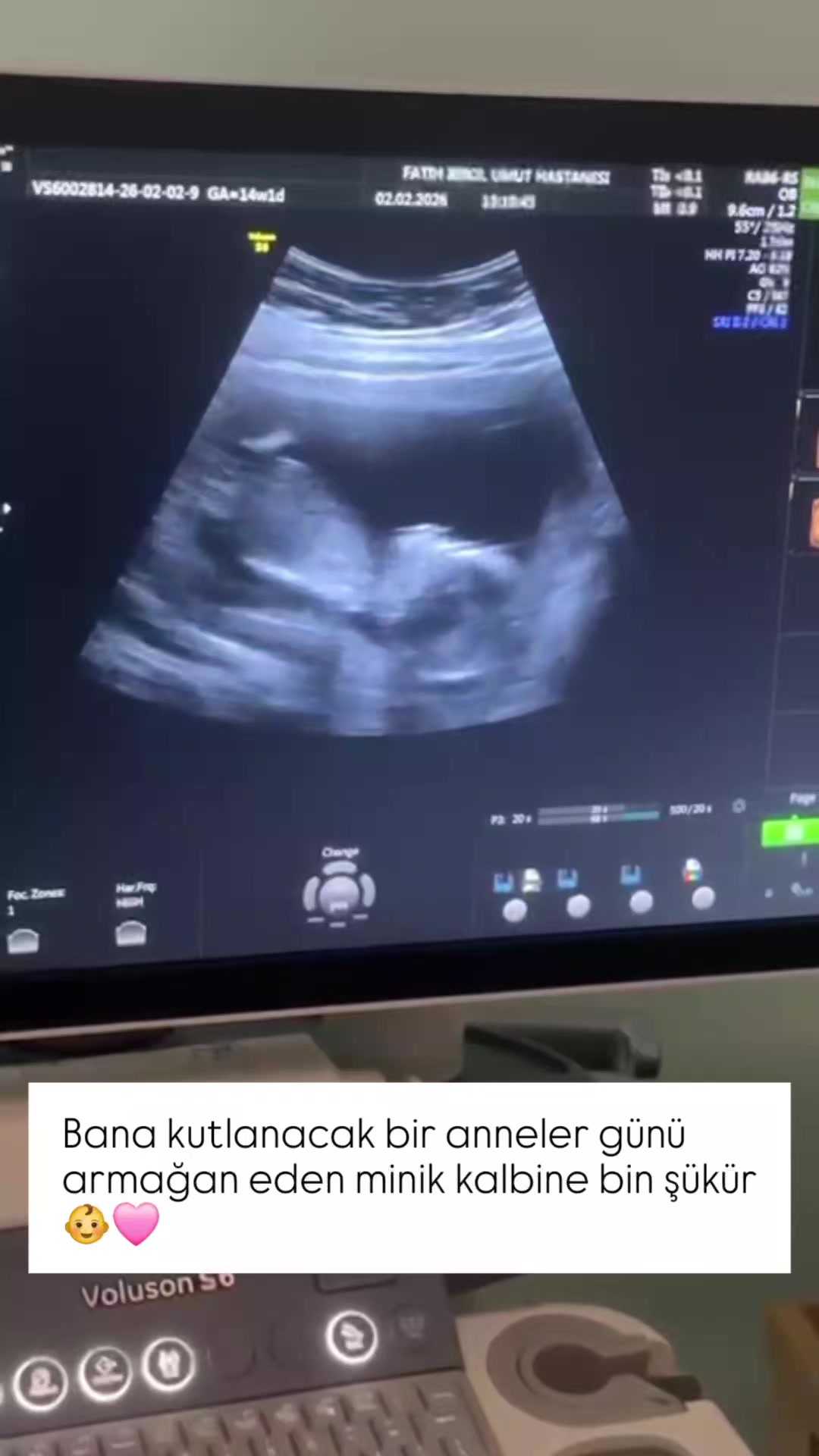 @gülo