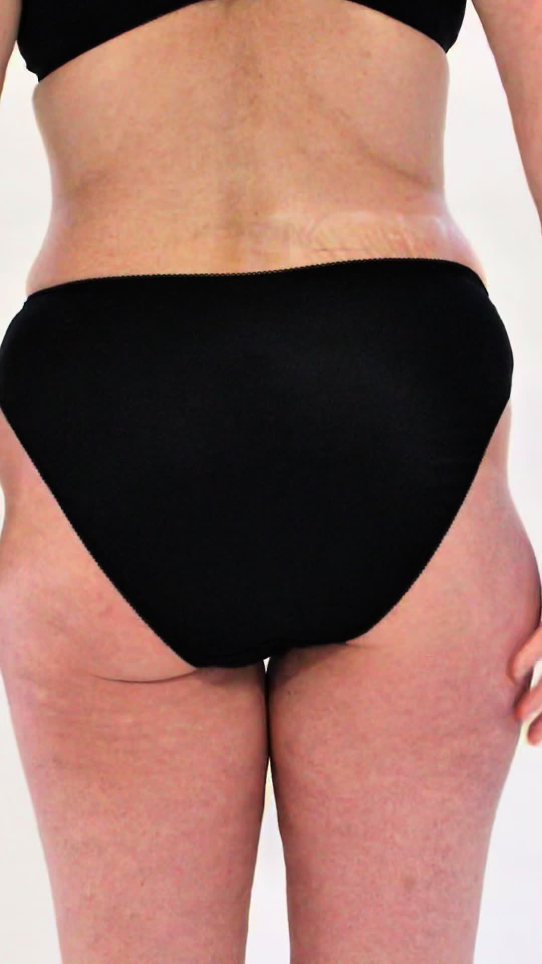 @Skinnies InstantLifts