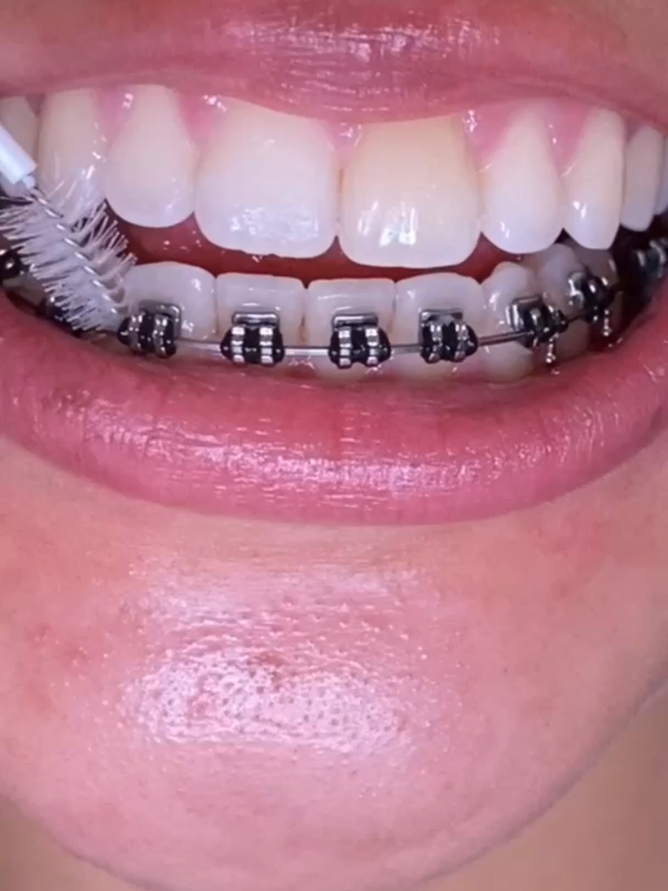 @Varietta Dental Care