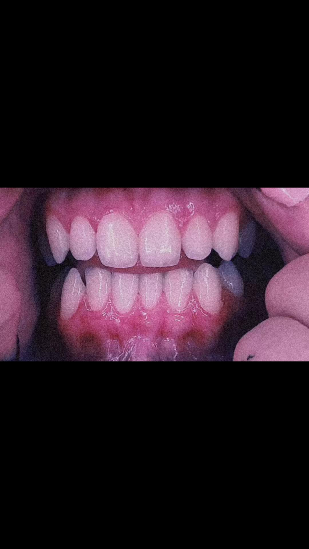 @•๐•