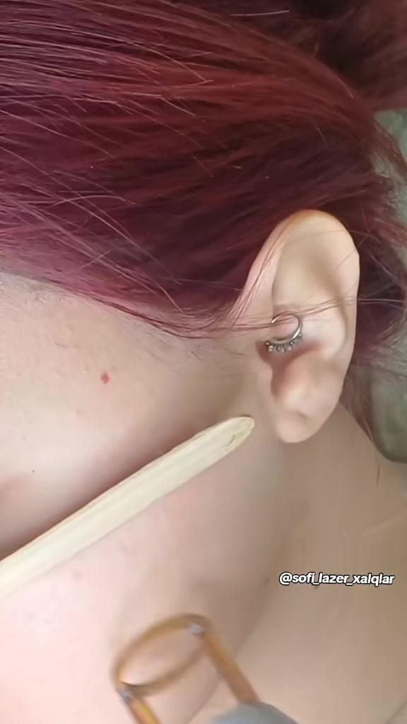 @𝑺𝒐𝒇𝒊 𝑳𝒂𝒛𝒆𝒓✨️