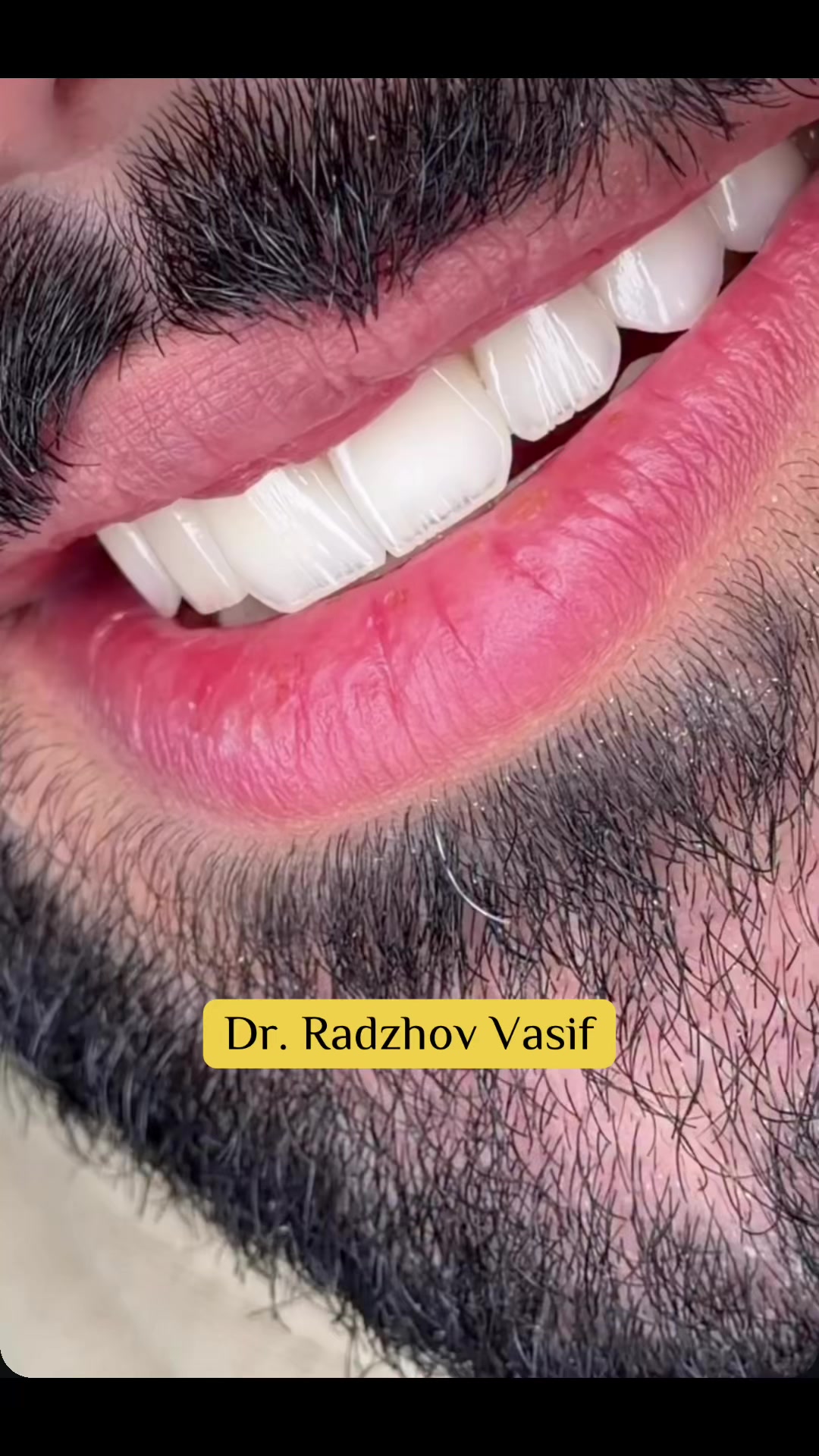 @Dr. Radzhov Vasif