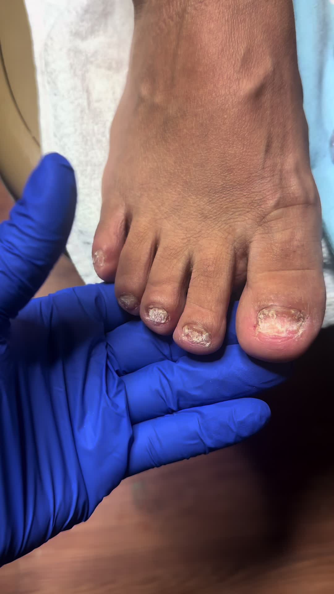 @ToesbyKoki