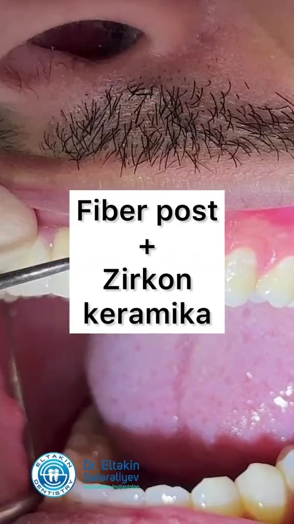 @eltakindentistry