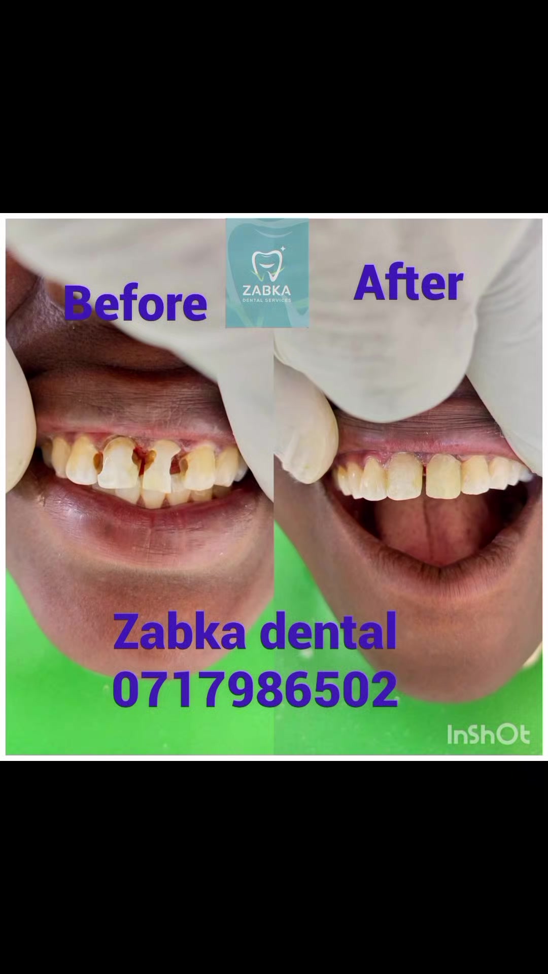 @Zabka Dental