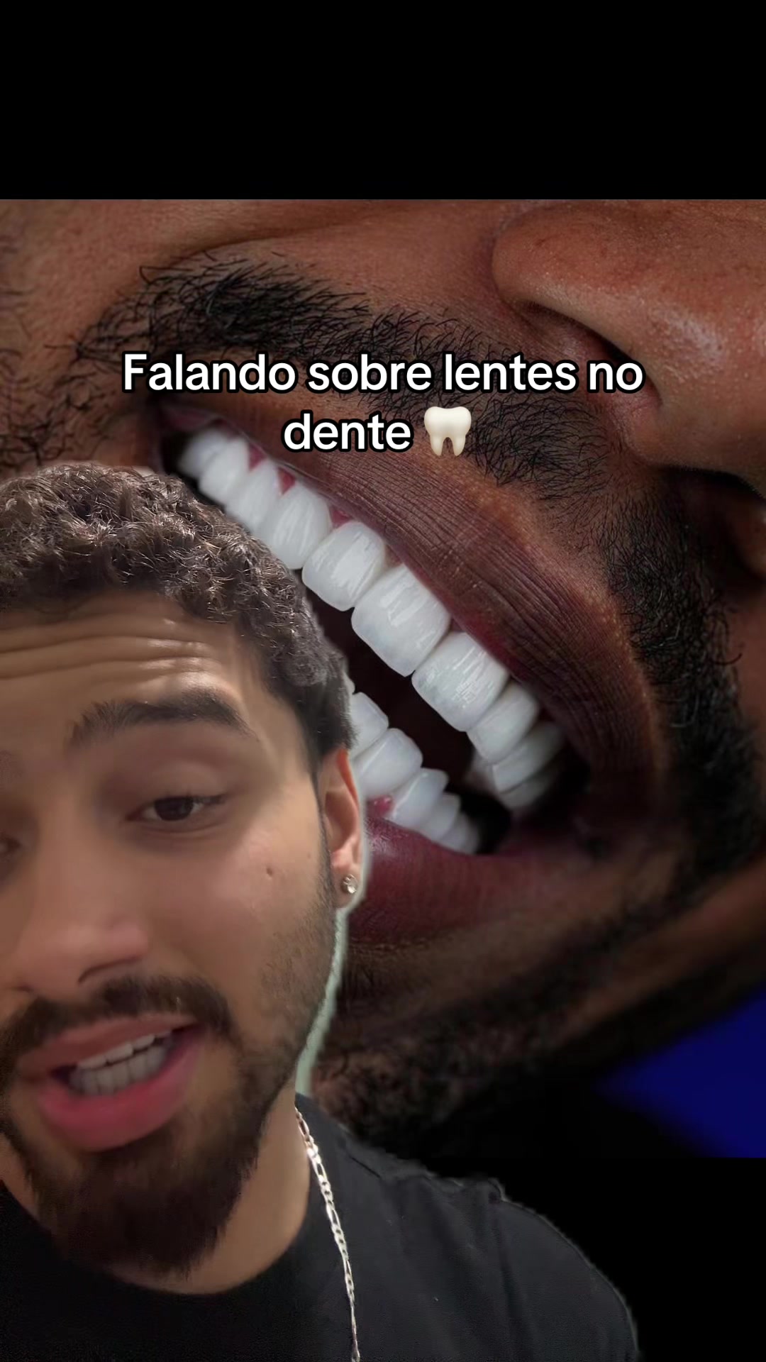 @Milo Pires
