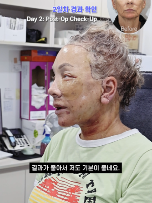 @다시피움성형외과 DASIPIUM タシピウム