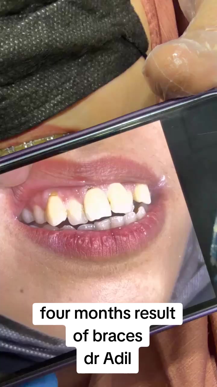 @Dr Adil khan 🦷🦷
