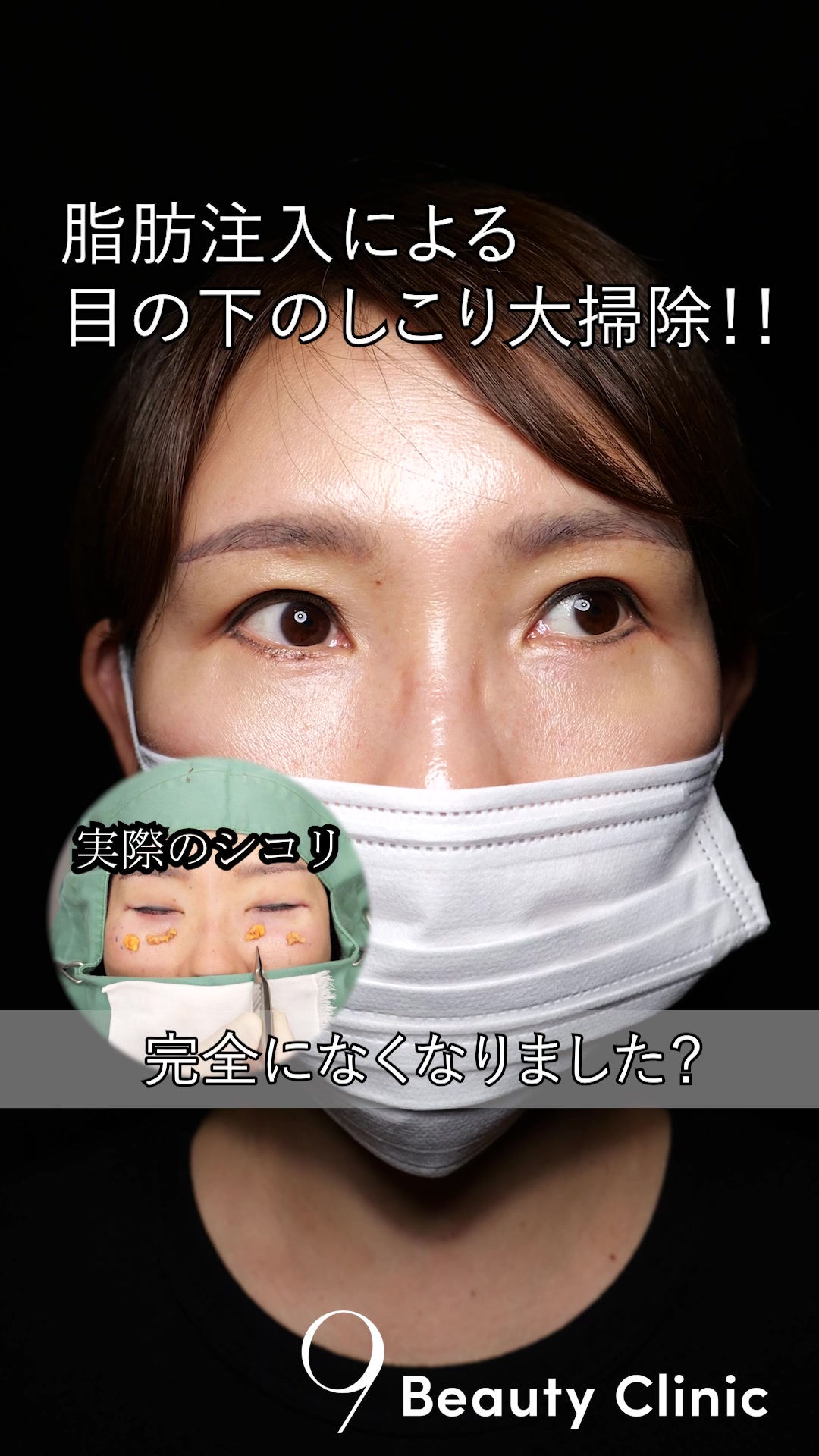 @りく先生　目元切開/クマ治療