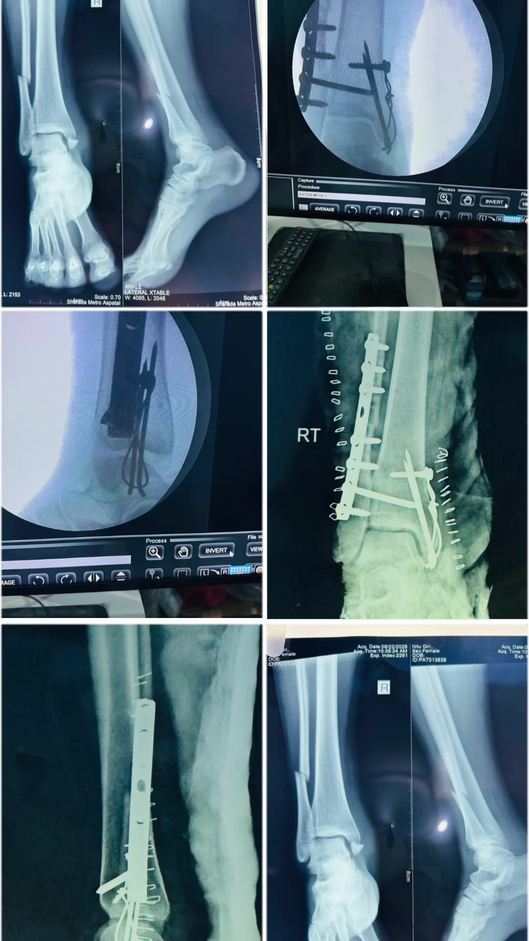 @Dr.Sanjay Gautam,Orthopedics🦴