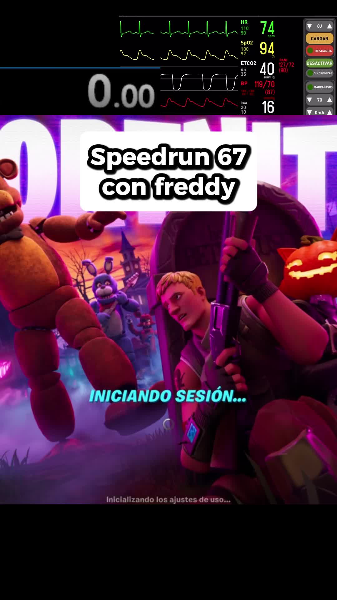 @Wizyfn30hz