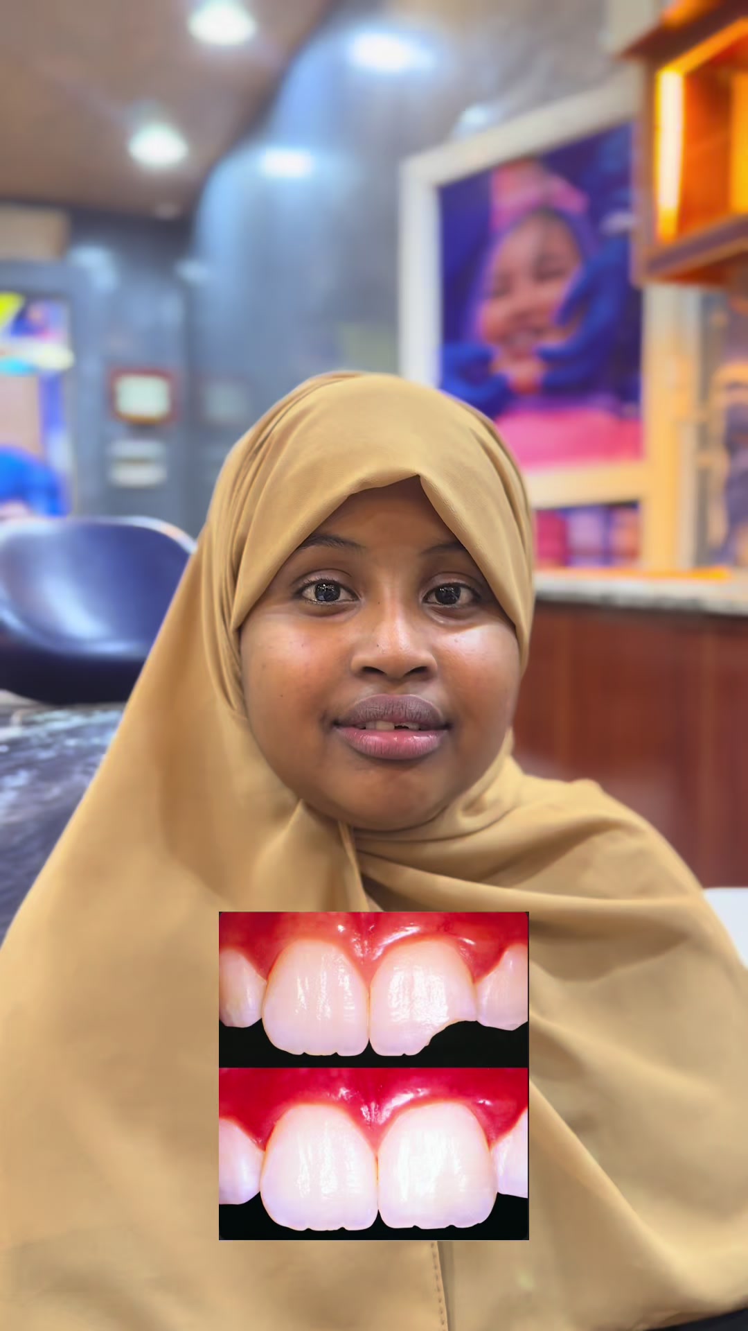 @DR.Mohani Said🇸🇴🦷🇲🇾