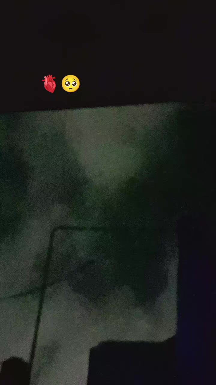 @๐จ๐๐๐๐๐๐๐๐๐ฉ๐๐๐๐