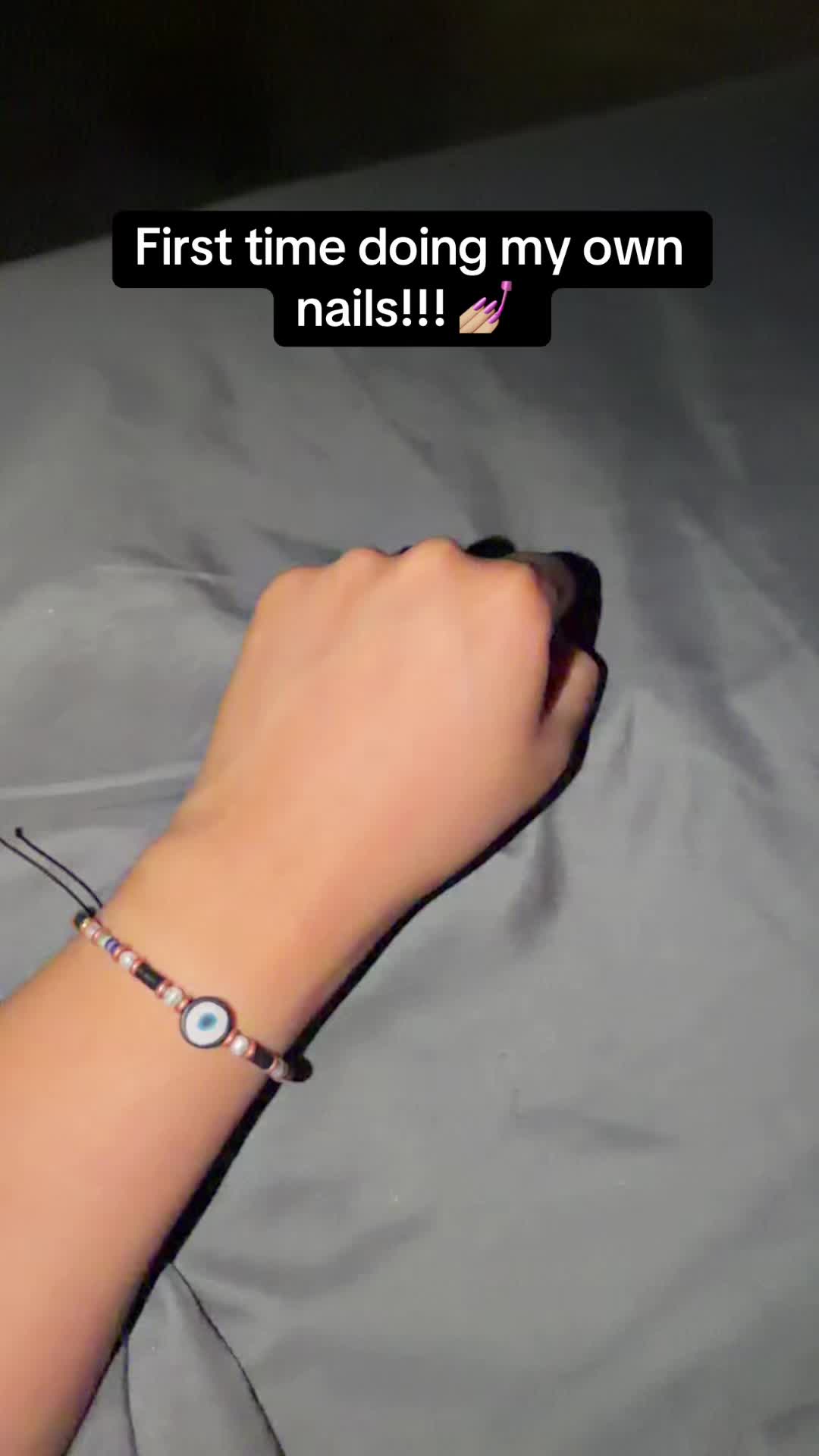 @Alexis ✗0️