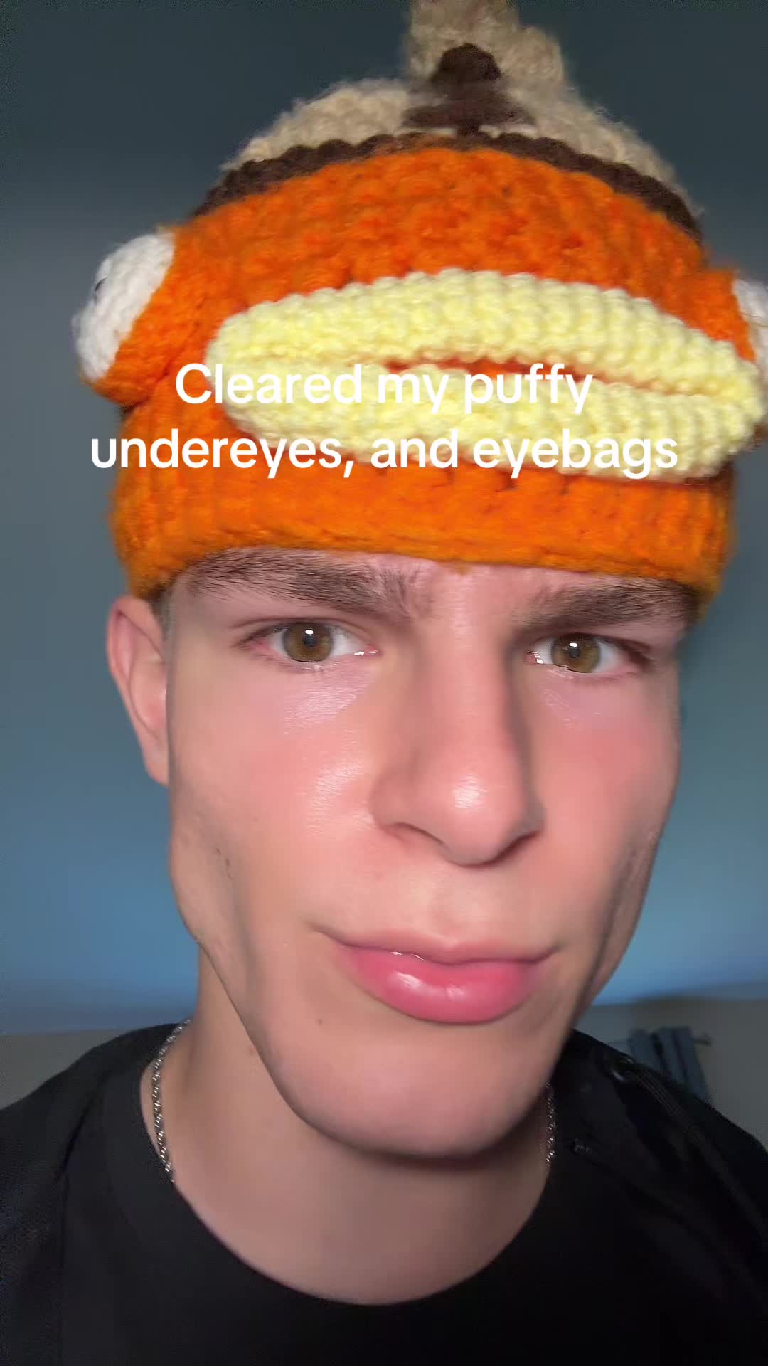 @Finn