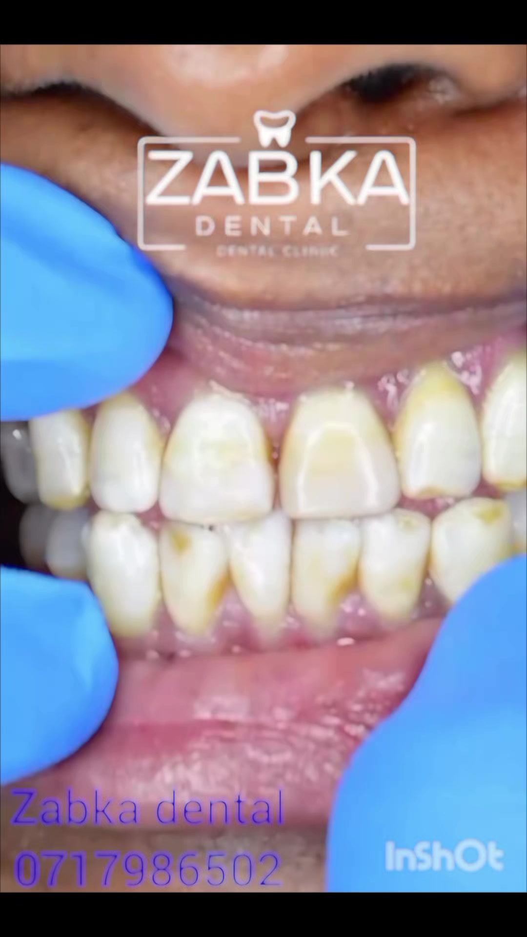 @Zabka Dental