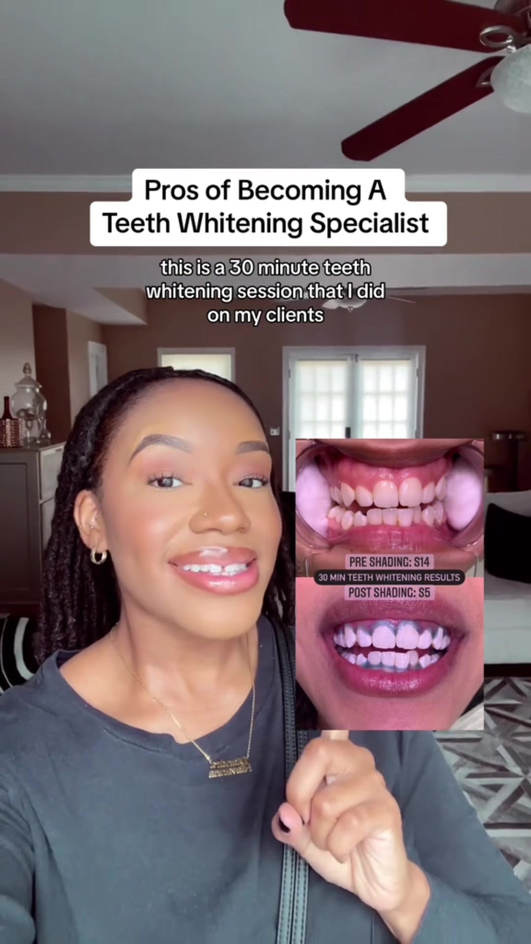 @Diandra | Teeth Whitening Tech