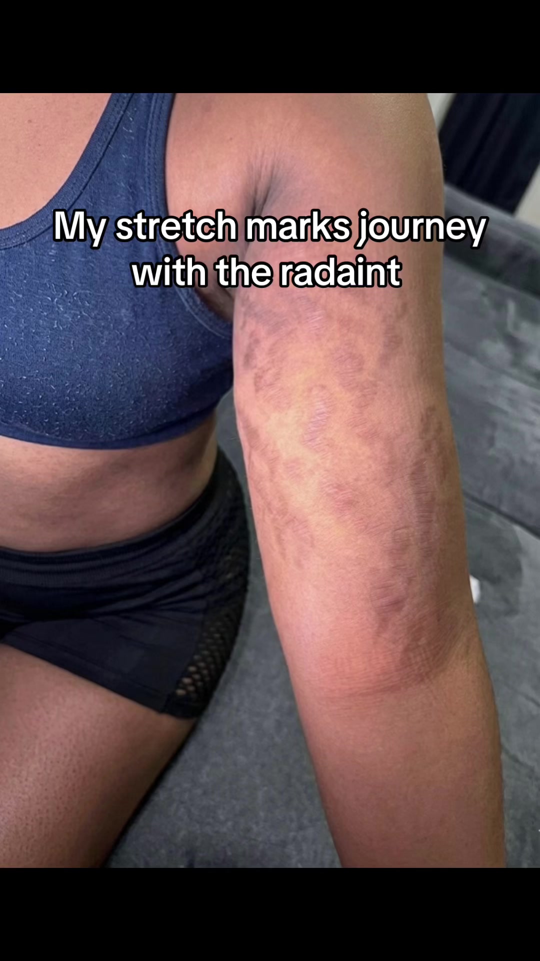 @Radiant skin