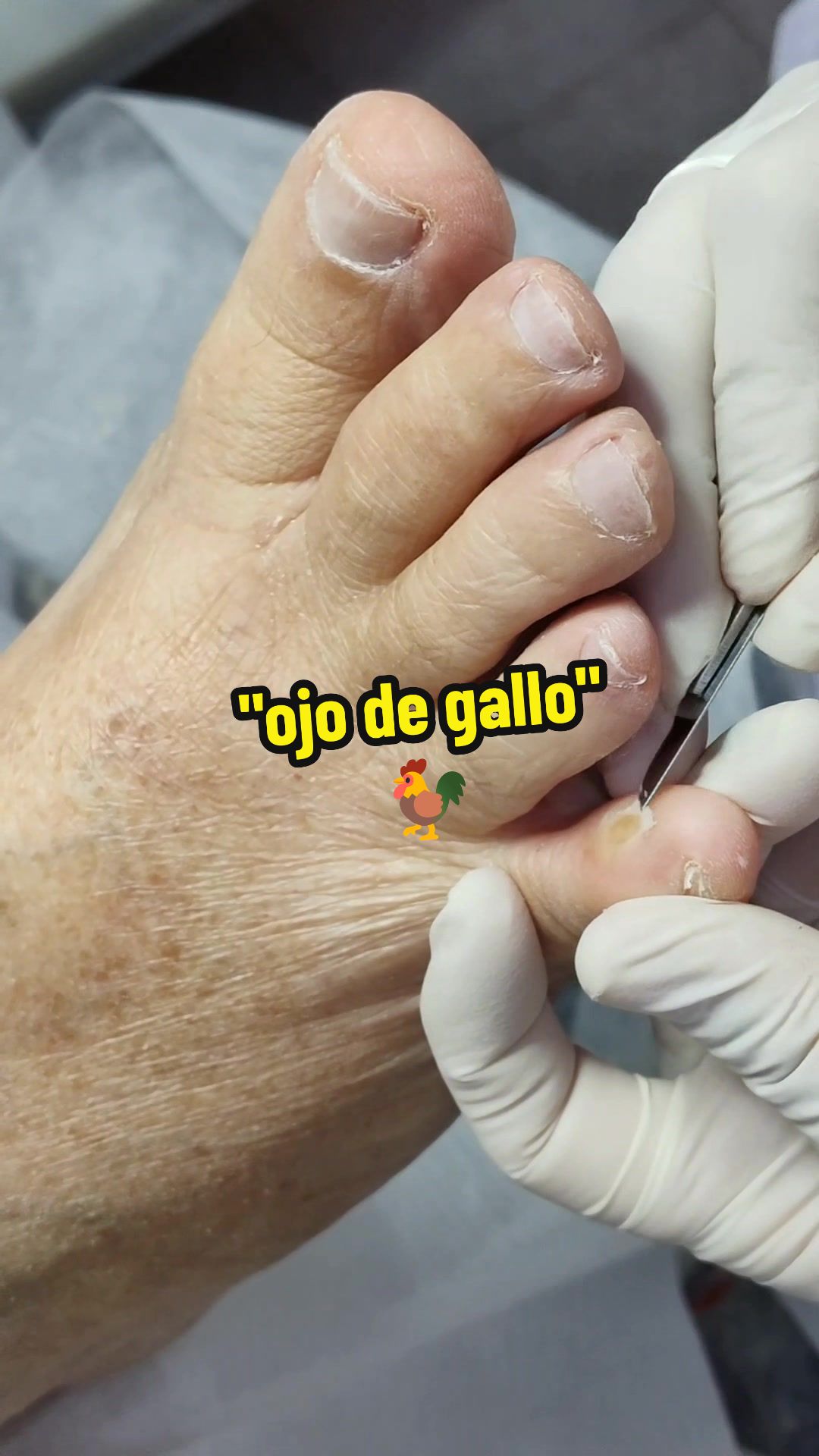 @podología calzada