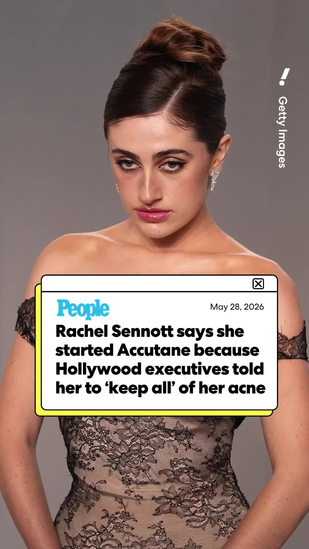 @Yahoo Entertainment