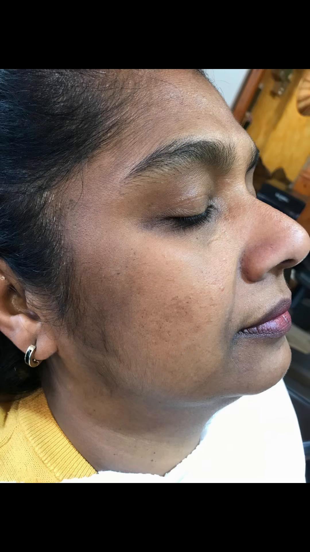 @THILI SKIN CARE CENTER