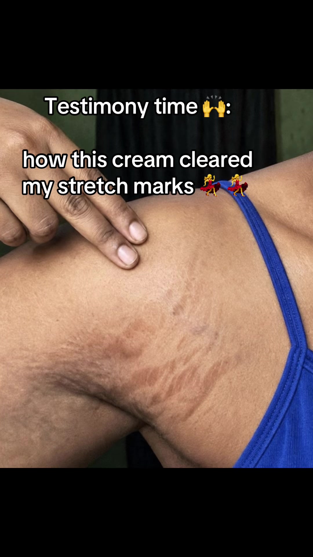 @Radiant skin