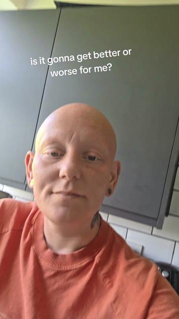 @baldies_adventures
